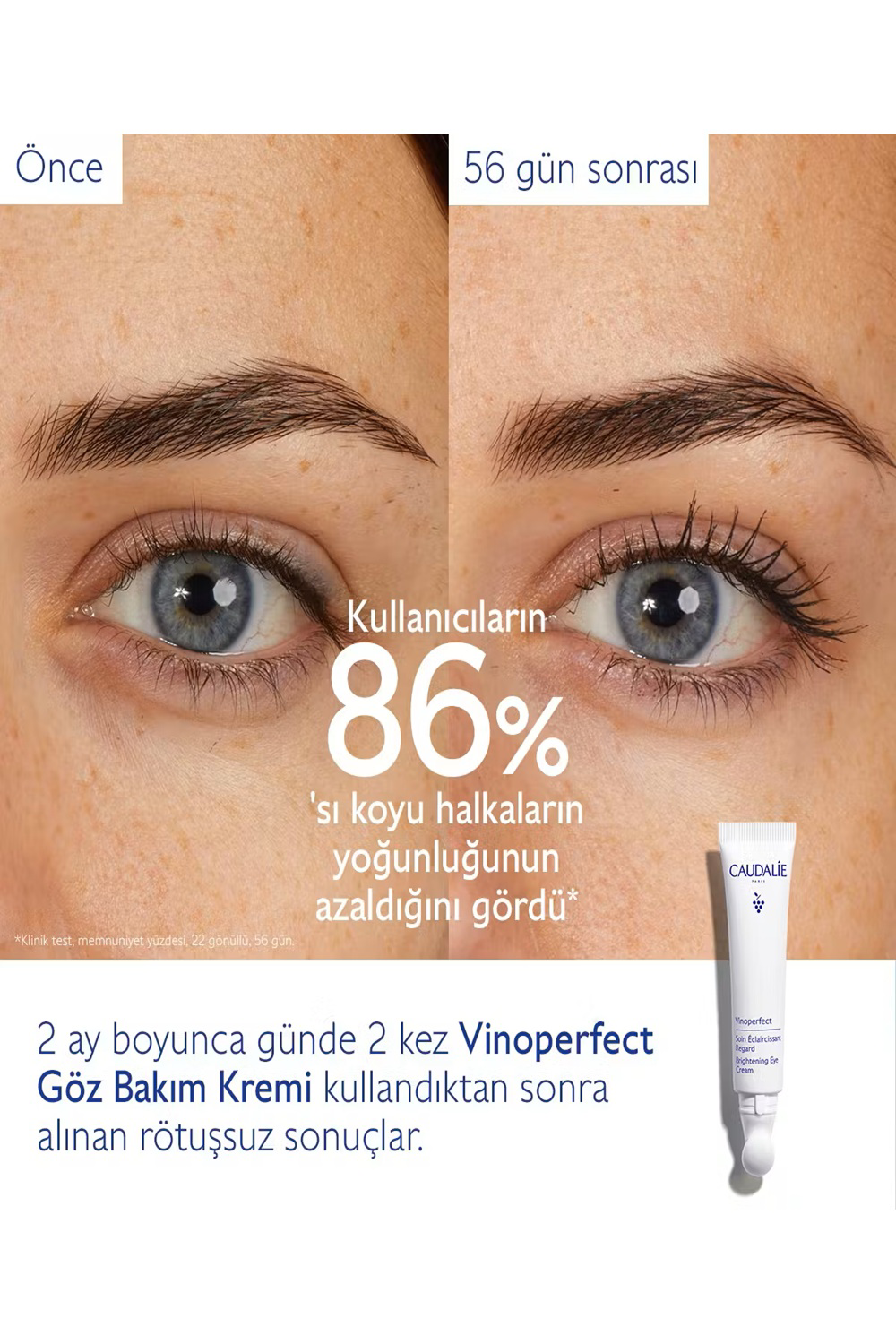 Caudalie  Vinoperfect İşilti Verici Göz Bakim Kremi 15 Ml