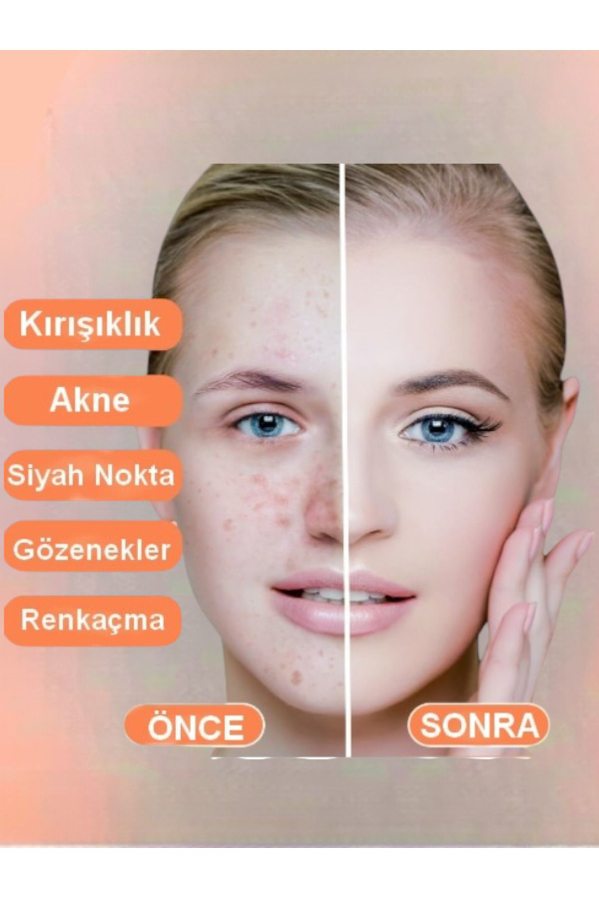 Trendmilano Kojic Asit Sabunu, Zerdeçal Ve Kojik Asit Etkisi İle Leke Karşiti