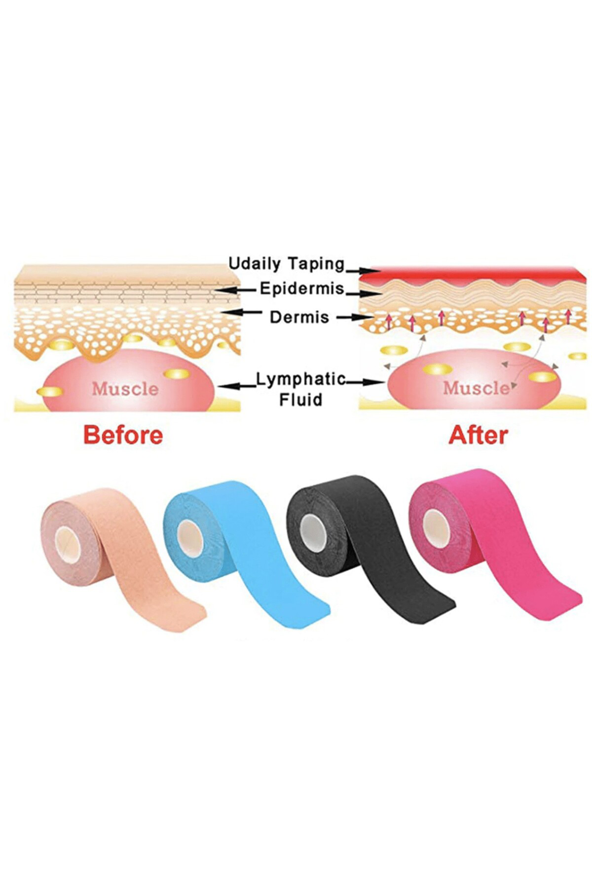 Fizyopol New Product Kinezyo Tape Band 5 Metre X 5 Cm Pembe Renk Kinesio S