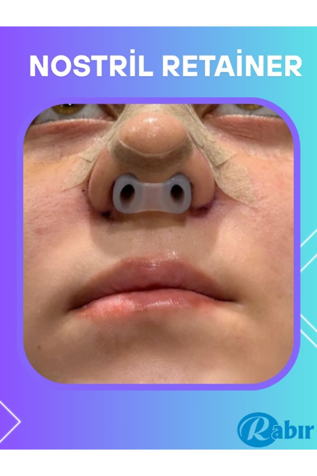 Rabir Nostril Retainer No 8 Burun Deliği Şekillendirici
