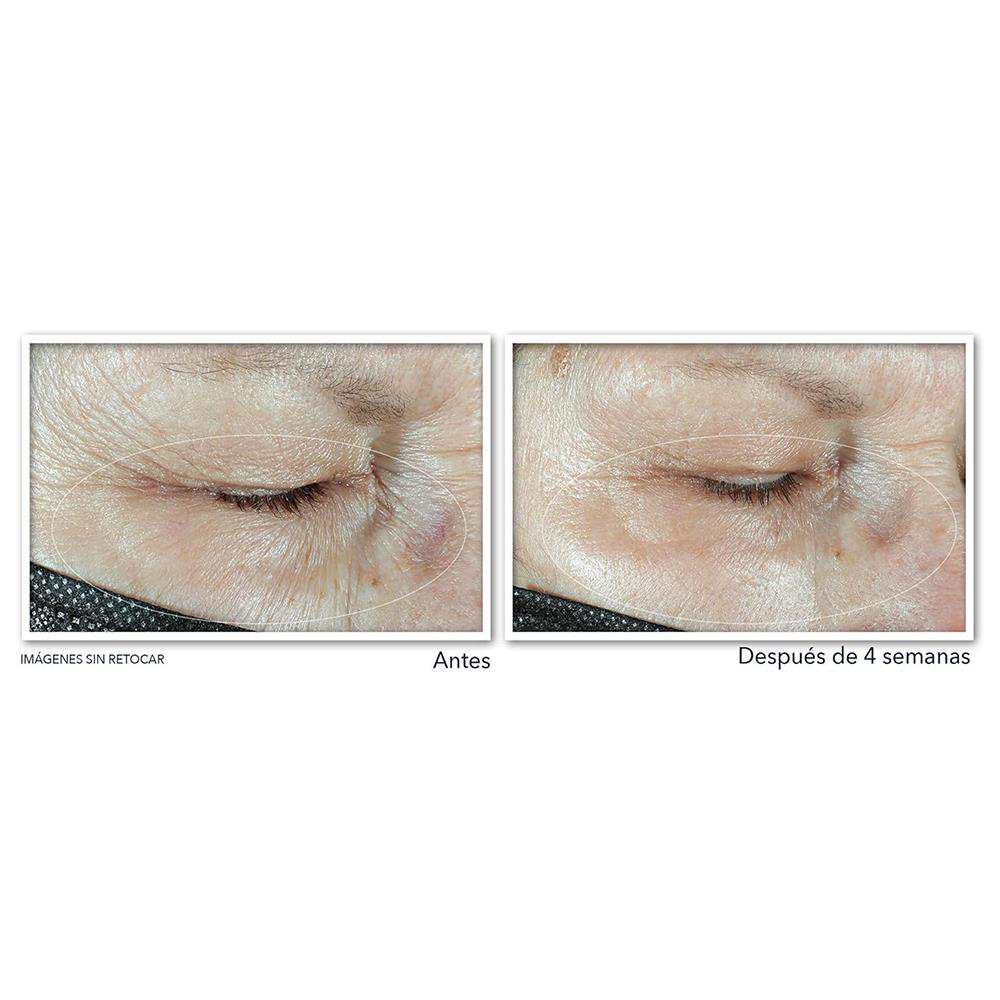 Roc  Multi Correxion Hydrate Plump Göz Çevresi Kremi 15Ml
