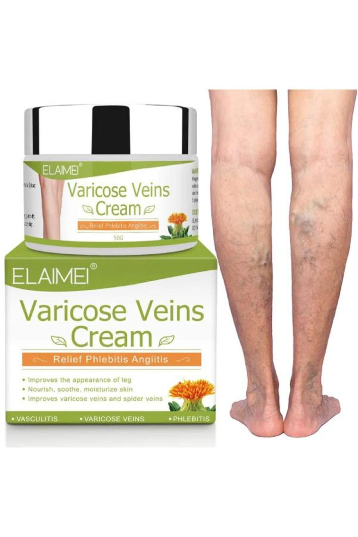 Elaimei Spider Varicose Veins Var.İs Diz Bacak Ayak Bakim Kremi 1 Adet X