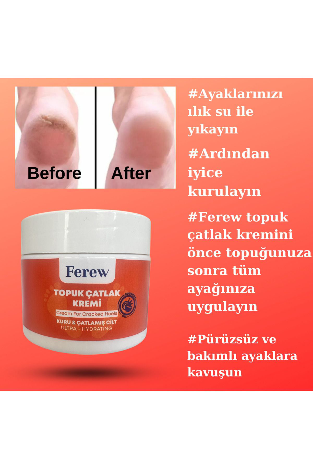 Ferew Topuk Çatlak Kremi 100 Ml