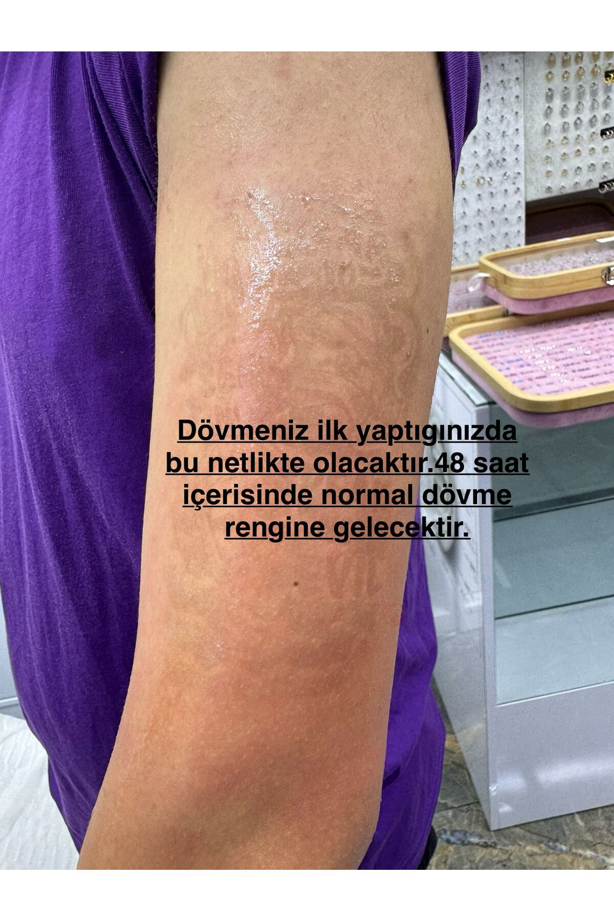 Arescollection 1 Ay Kalici 12 Saat Sonra Kararan Mandala Yari Kalici Tattoo Geçi