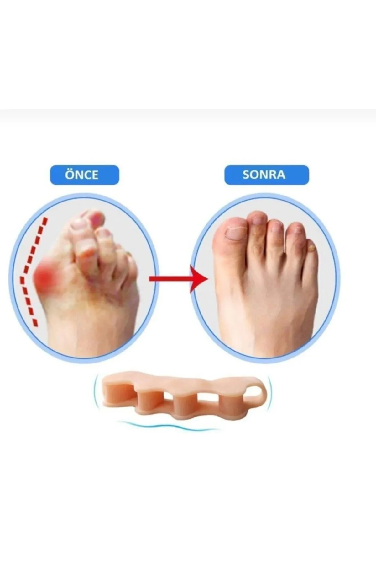 1 Çift Ayak 5 Parmak Ayırıcı Aparat - Görsel 3