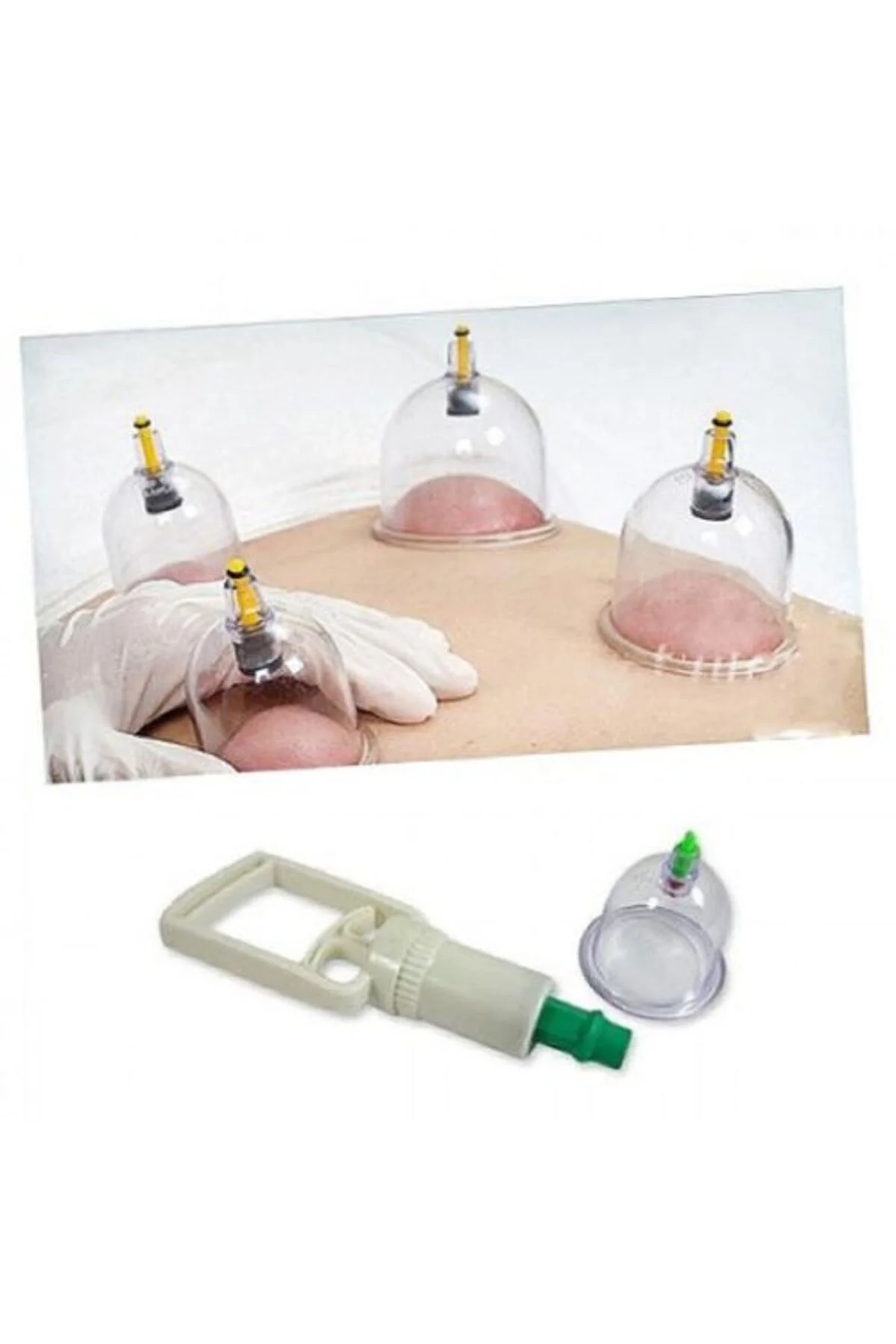 12 Parça Vakumlu Hacamat Kupa Çekme Seti