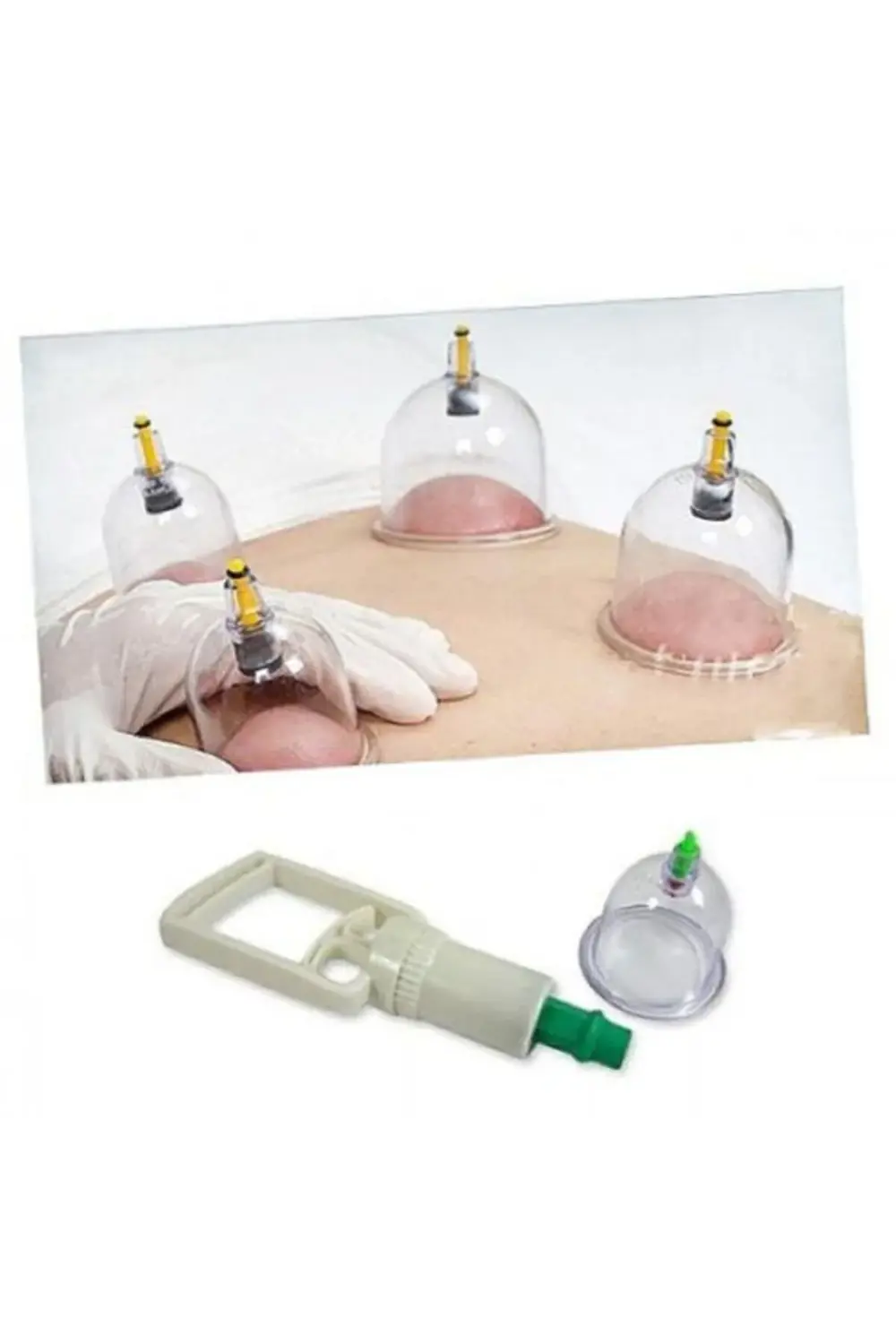 12 Parça Vakumlu Hacamat Kupa Çekme Seti