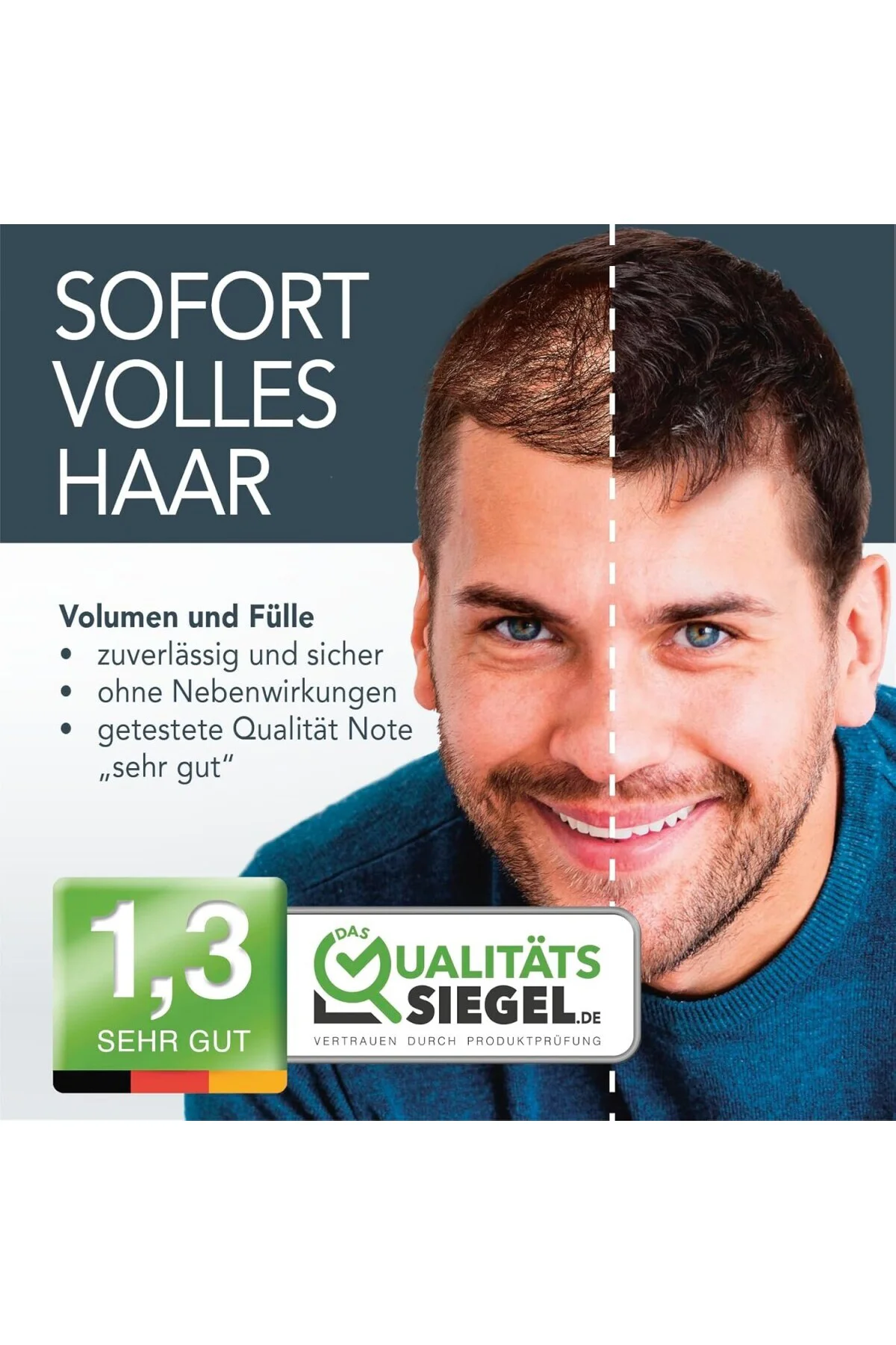 14 Gram Saç Fiberi Dolgunlaştırıcı Kellik Kapatıcı Siyah Toz (Top 14 Gram Saç Fiberi Dolgunlaştırıcı Kellik Kapatıcı Siyah Toz (Top