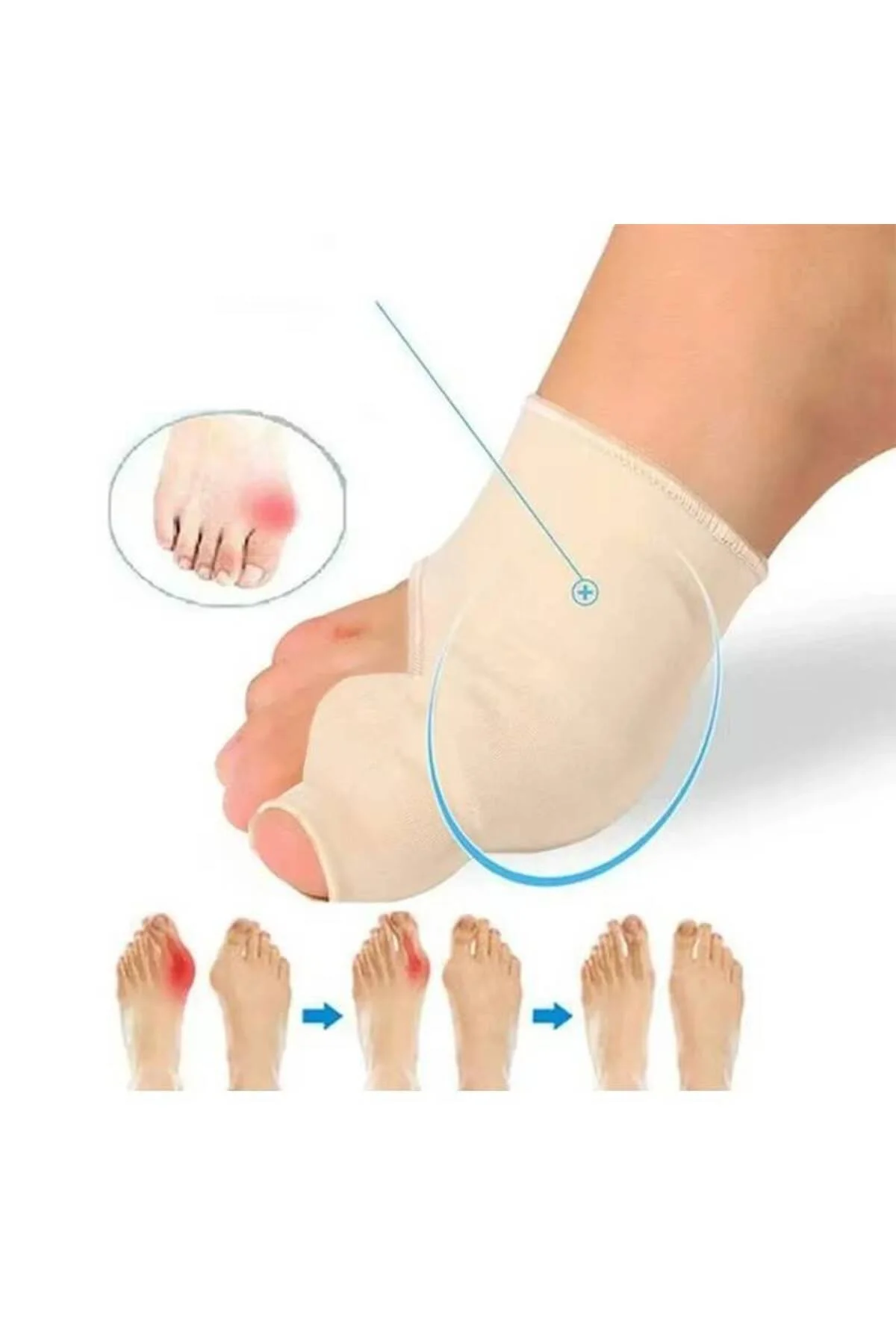 2 Adet Tekstil Makaralı Bunyon Koruyucu Halluks Valgus 2 Adet Tekstil Makaralı Bunyon Koruyucu Halluks Valgus
