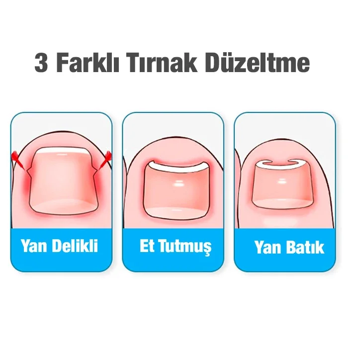 24 Parça Profesyonel Tırnak Bakım Seti – Manikür Pedikür ve Batık Kurtarma