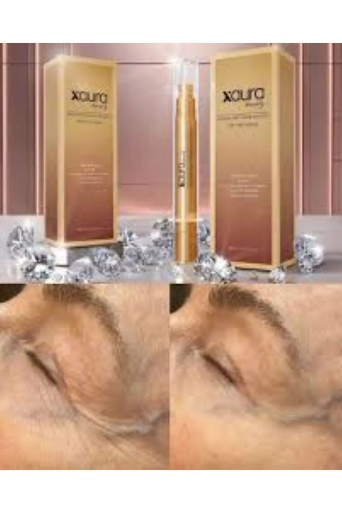 8 Milyon Mikro Iğne Içeren Kalıcı Botoks Etkili Anti-aging Kremi,