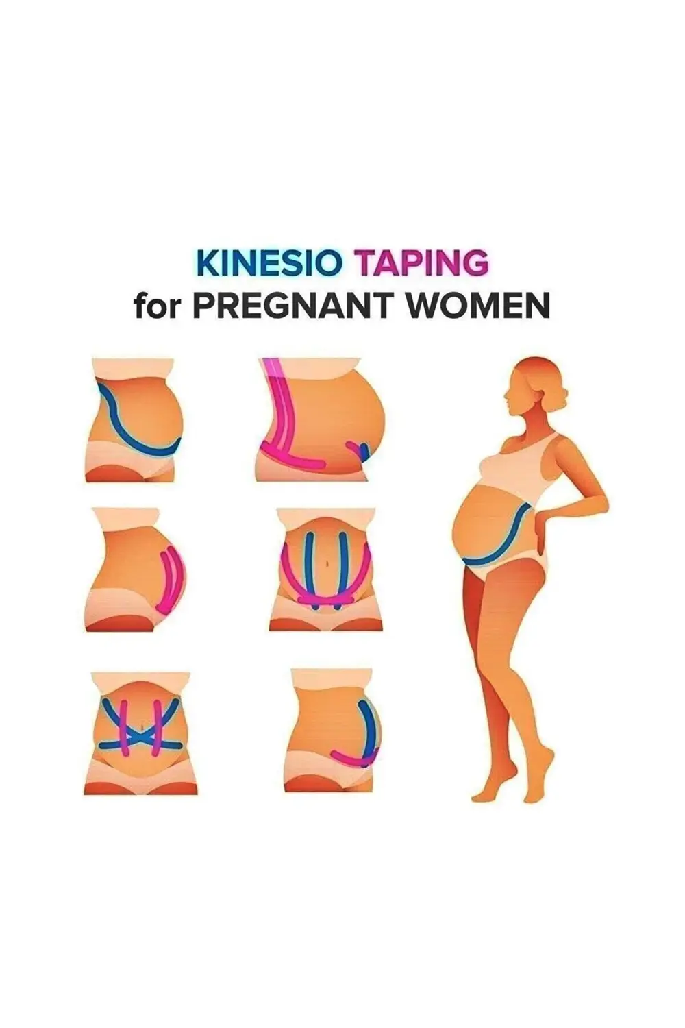 Ağrı Bandı Kinesiotape Bantlama Sporcu Bandı Sakatlık Bandı Kines