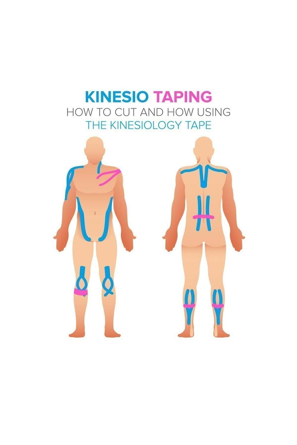 Ağrı Bantları Kinezyo Bandı 5cmx5m