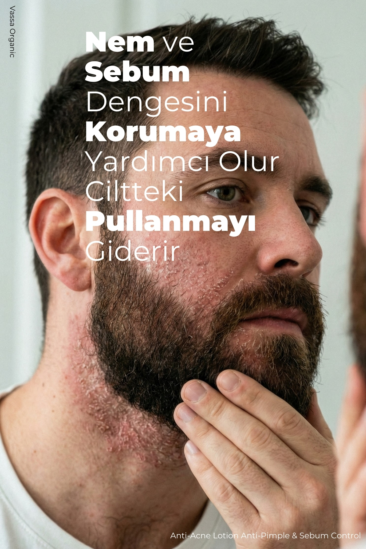 Akne, Sivilce ve Leke Karşıtı Onarıcı Bakım Kremi – Akne ve Sivilce Karşıtı Krem 100 ml