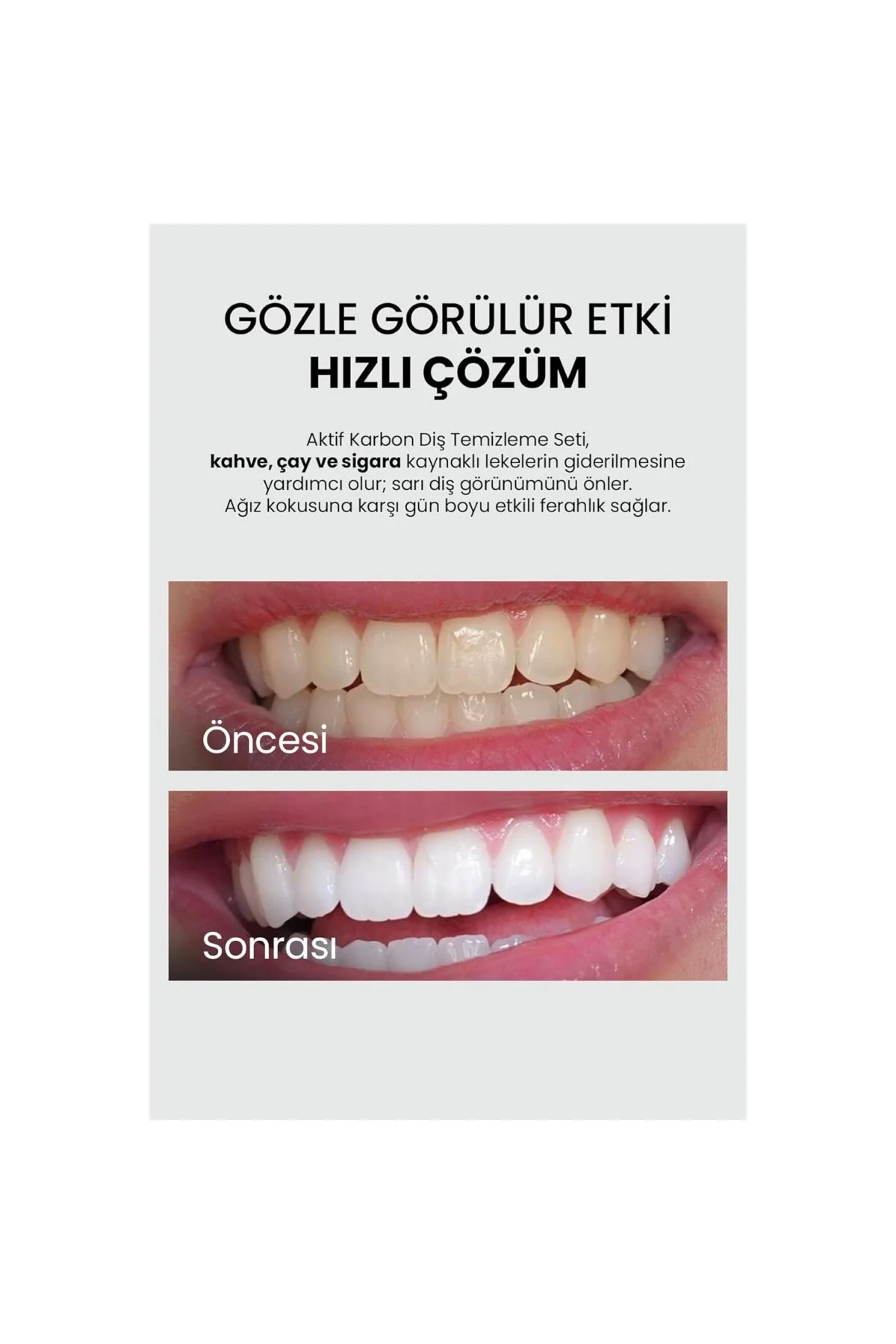 Aktif Karbon Diş Beyazlatma Macunu 75 ml