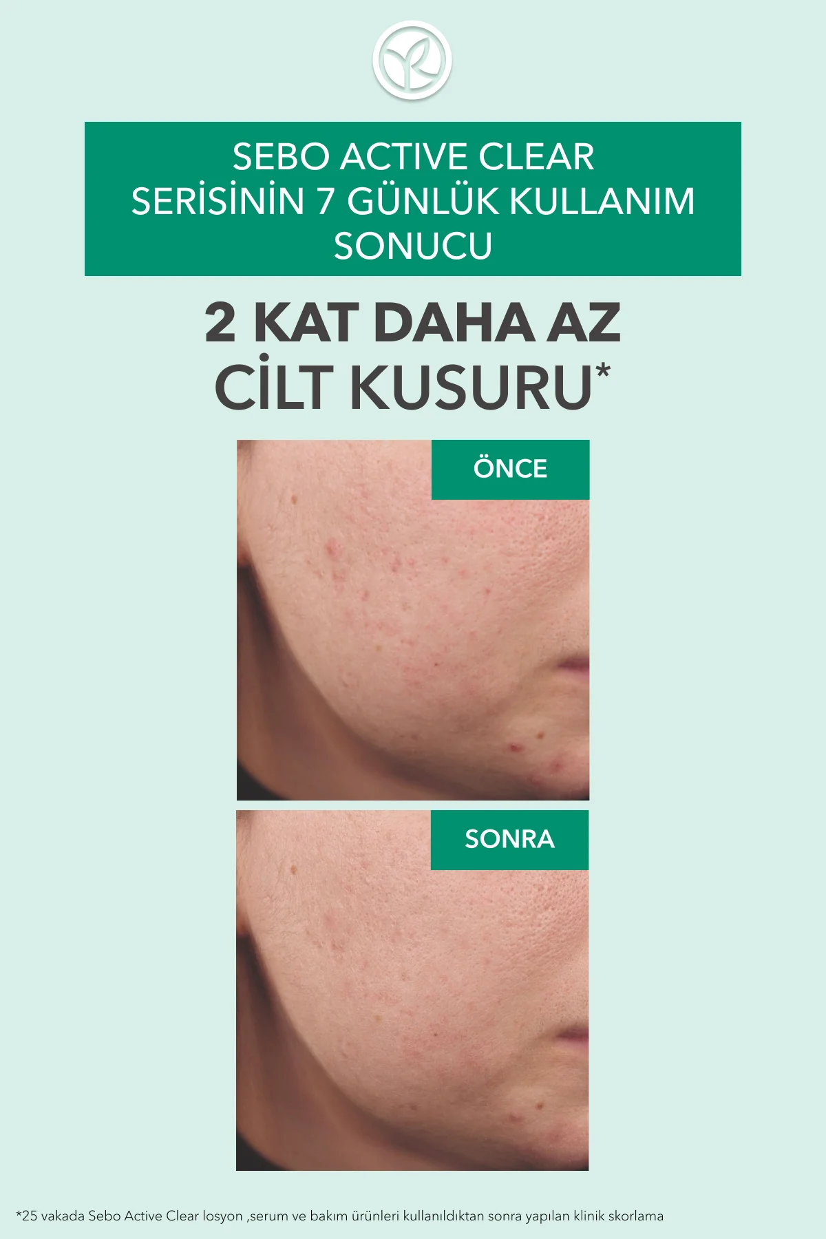 Arındırıcı Yağ Dengeleyici Serum-Süksinik Asit&Çinko-Sebo Active 