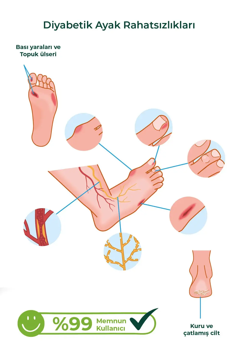 Ayak Bakım Kremi x 3 adet– Uyumlu & Hassas Ciltlere Özel (%10 Üre Ayak Bakım Kremi x 3 adet– Uyumlu & Hassas Ciltlere Özel (%10 Üre