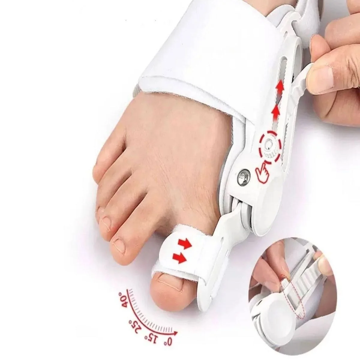 Ayarlanabilir Ayak Baş Parmak Kemik Düzeltici – Halluks Valgus (bunyon) Aparatı, Gece Gündüz Kullanıma Uygun Ayak Düzeltme Ateli Bx40 Fiyatı, Yorumları ve Özellikleri