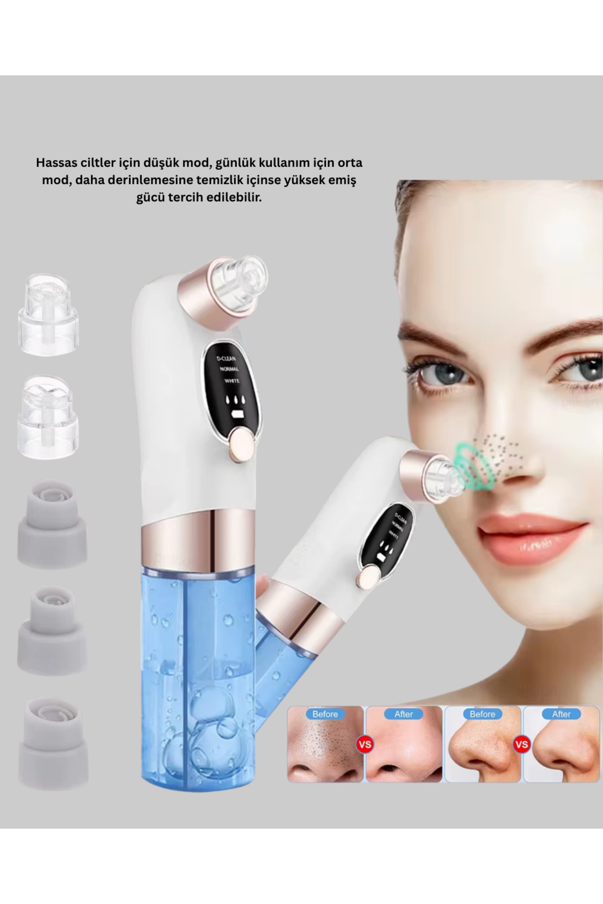 Ayarlanabilir Güç Seviyeli Vakumlu Siyah Nokta Temizleme Cihazı –