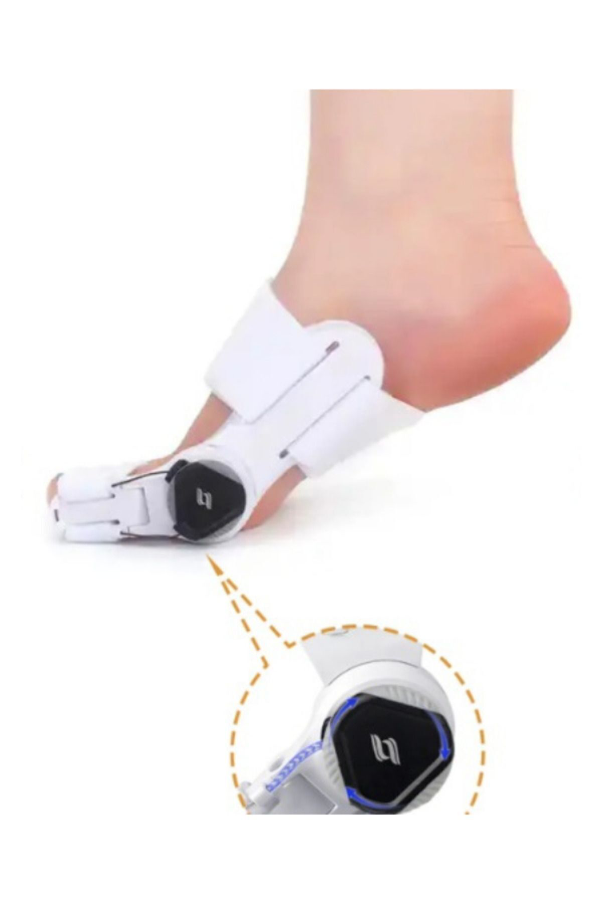 Ayarlı Baş Parmak Kemik Düzeltici - Halluks Valgus - Baş Parmak E