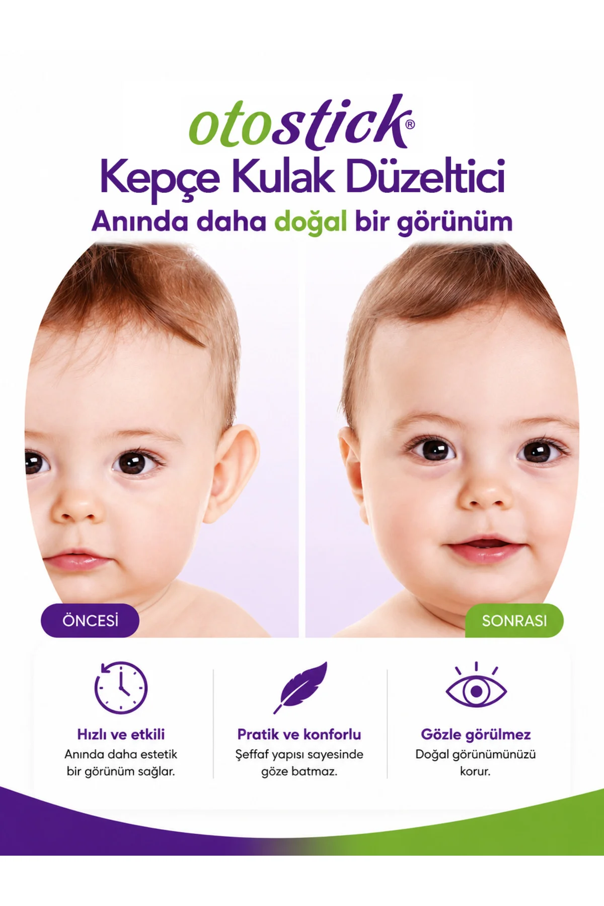 Baby Bebek Çocuk Kepçe Kulak Düzeltici