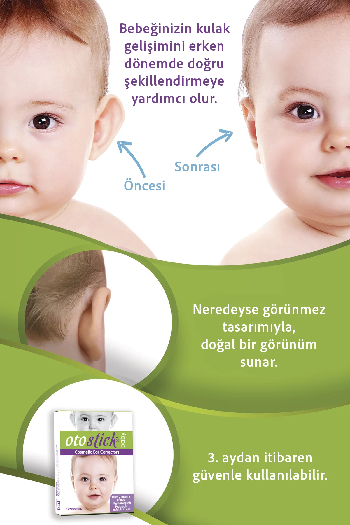 Baby Bebek Çocuk Kepçe Kulak Düzeltici