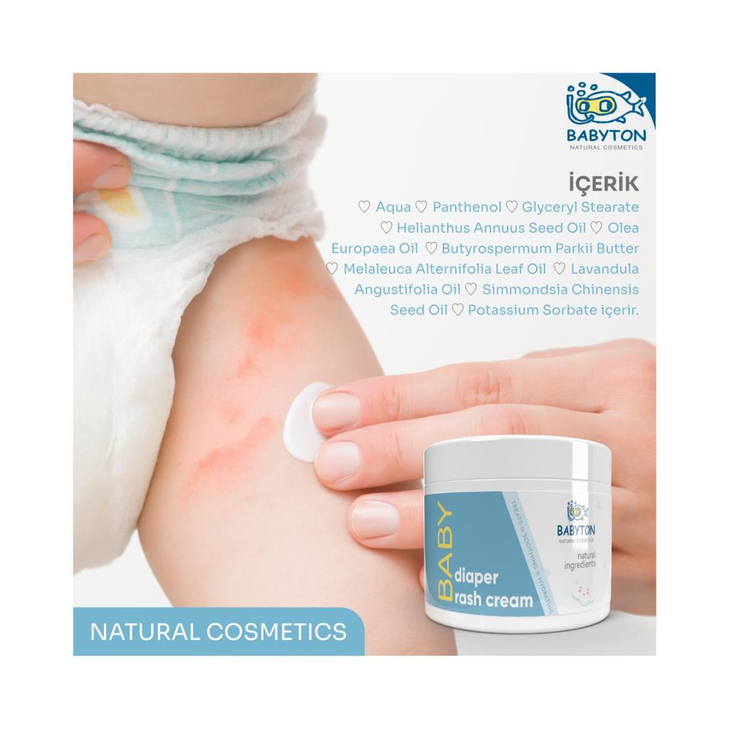 Babyton Pişik Önleyici Krem 50 ml Babyton Pişik Önleyici Krem 50 ml