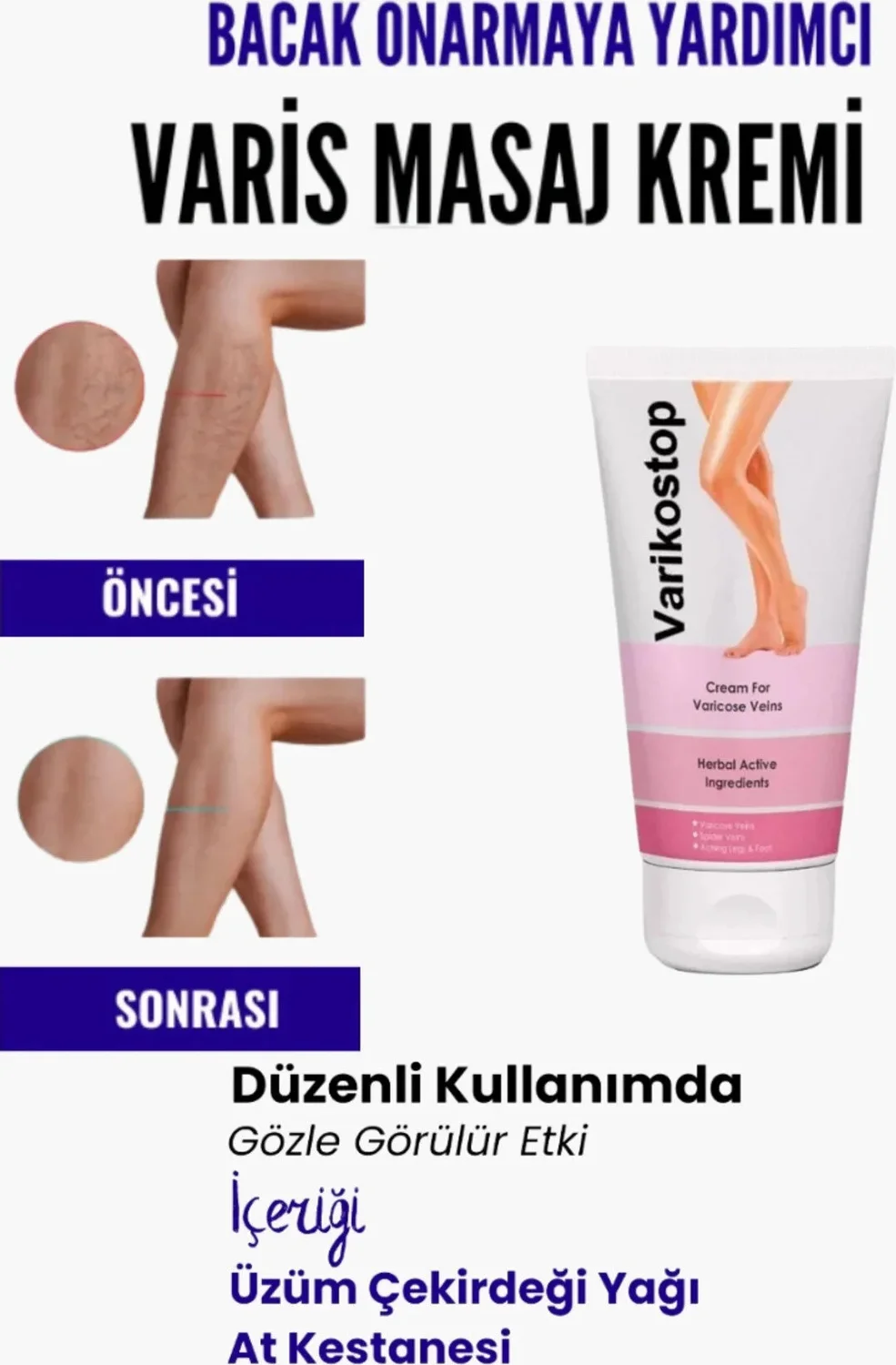 Bacak Varikostop Masaj Kremi 200 ml – Varis ve Ağrıya Karşı Etkili Çözüm Fiyatı, Yorumları ve Özellikleri