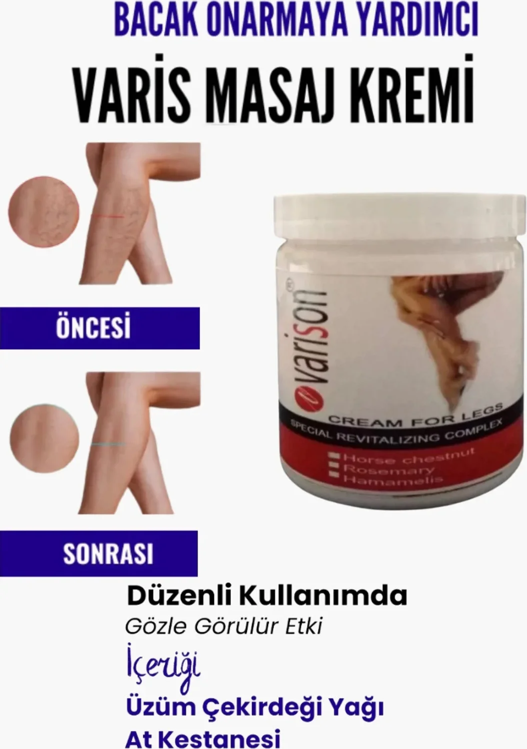 Bacak Yardımcı Varis Masaj Kremi 200 ml – Süper Bölgesi Fiyatı, Yorumları ve Özellikleri