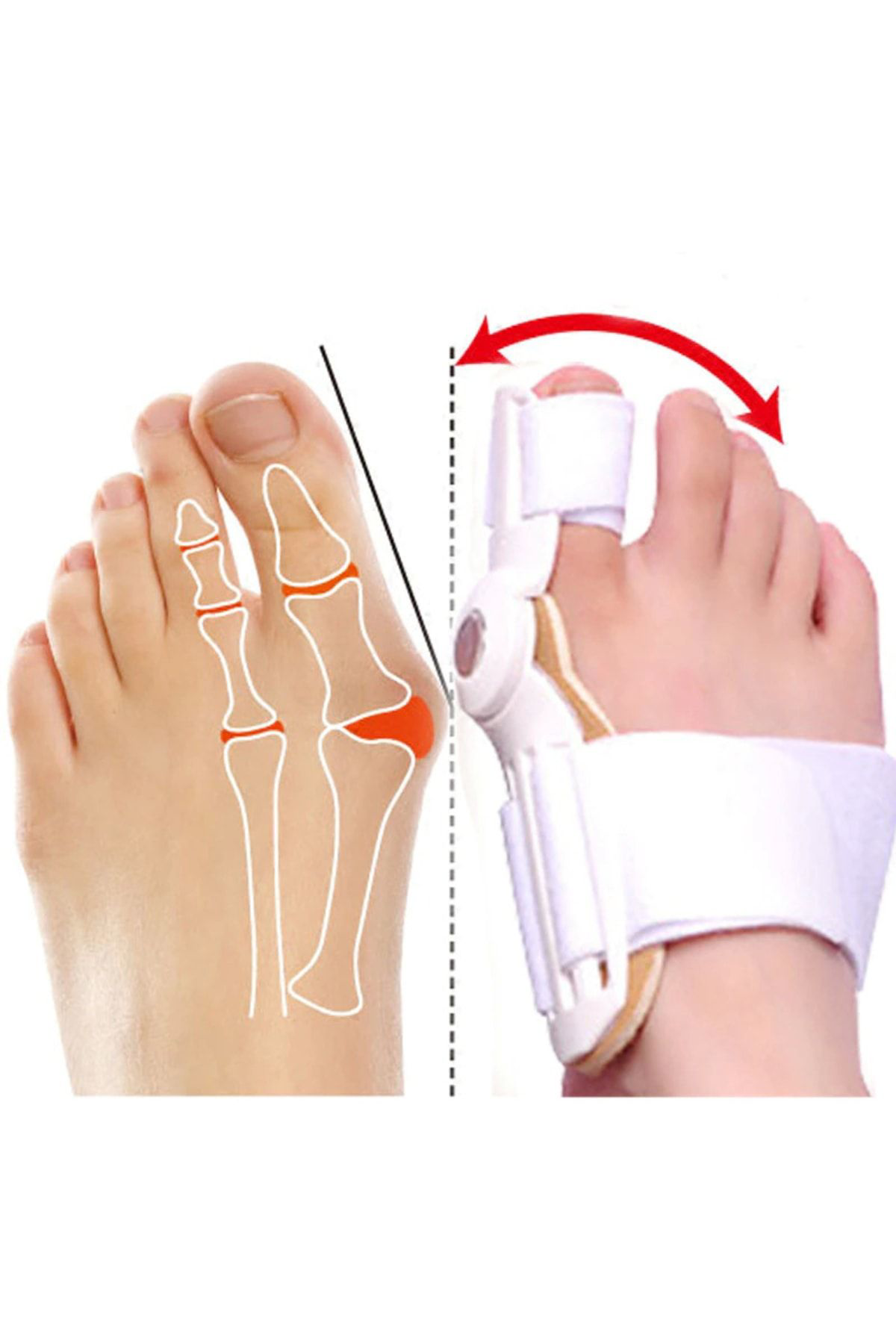 Baş Parmak Kemik Düzeltici Başparmak Kemik Eğriliği Düzeltici Gec