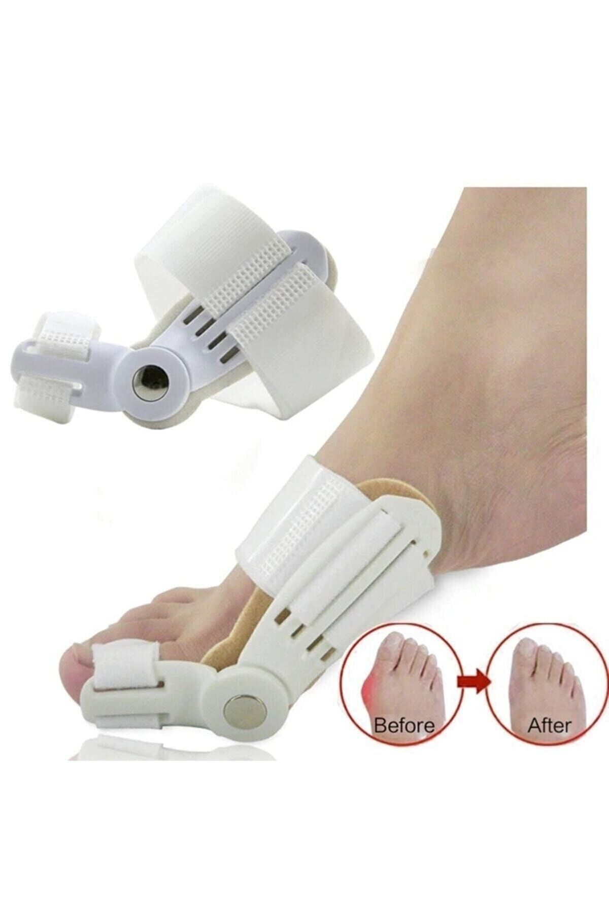 Baş Parmak Kemik Düzeltici Başparmak Kemik Eğriliği Düzeltici Gec