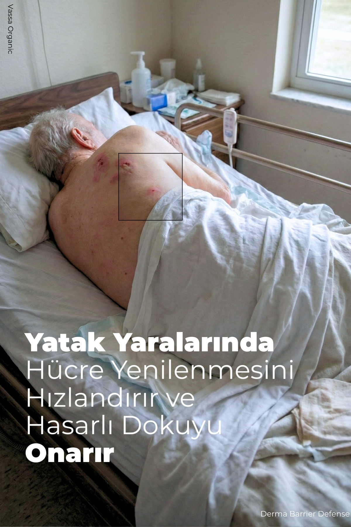 Bası ve Diyabetik Yaralar İçin Cilt Bariyerini Güçlendiren Bakım Kremi - Yatak Yarası Kremi 250 ml