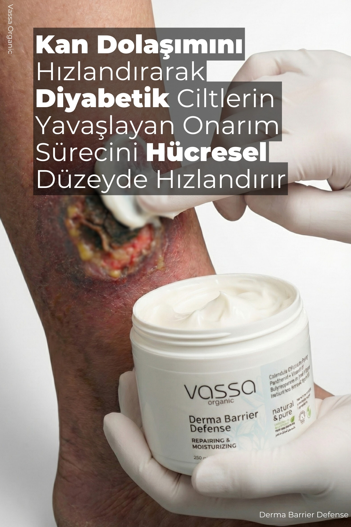 Bası ve Diyabetik Yaralar İçin Cilt Bariyerini Güçlendiren Bakım Kremi - Yatak Yarası Kremi 250 ml