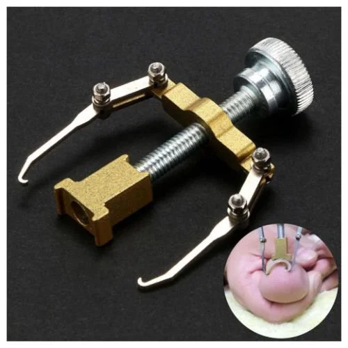 Batık Tırnak Düzeltme Aleti ile Sağlıklı ve Konforlu Ayak Bakımı