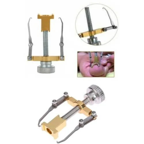 Batık Tırnak Düzeltme Aleti ile Sağlıklı ve Konforlu Ayak Bakımı