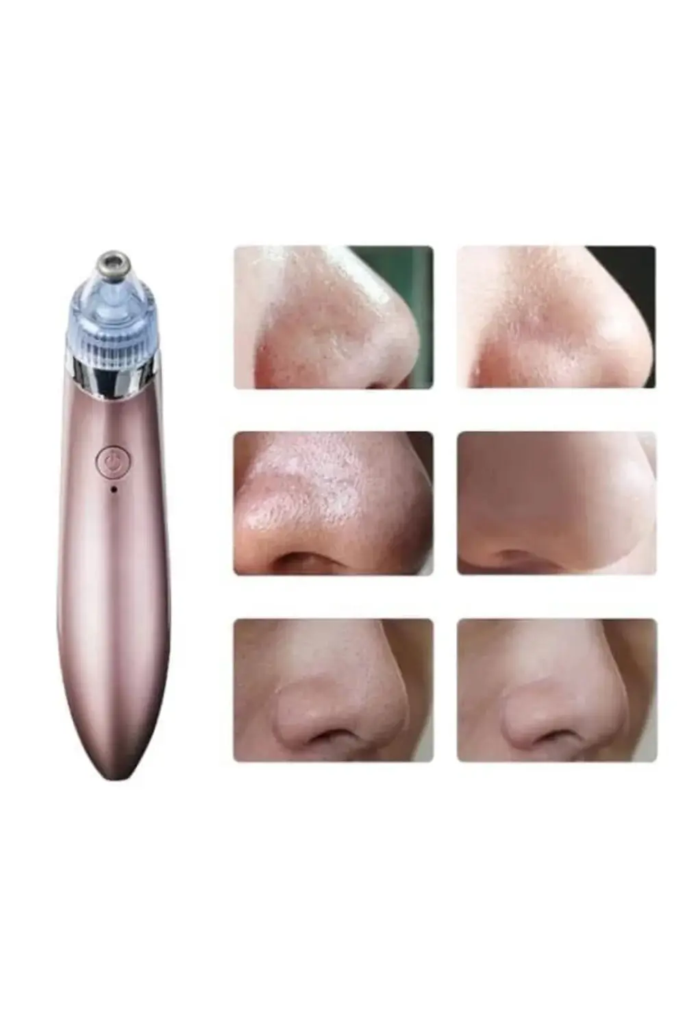 BFS SİYAH NOKTA CİHAZI