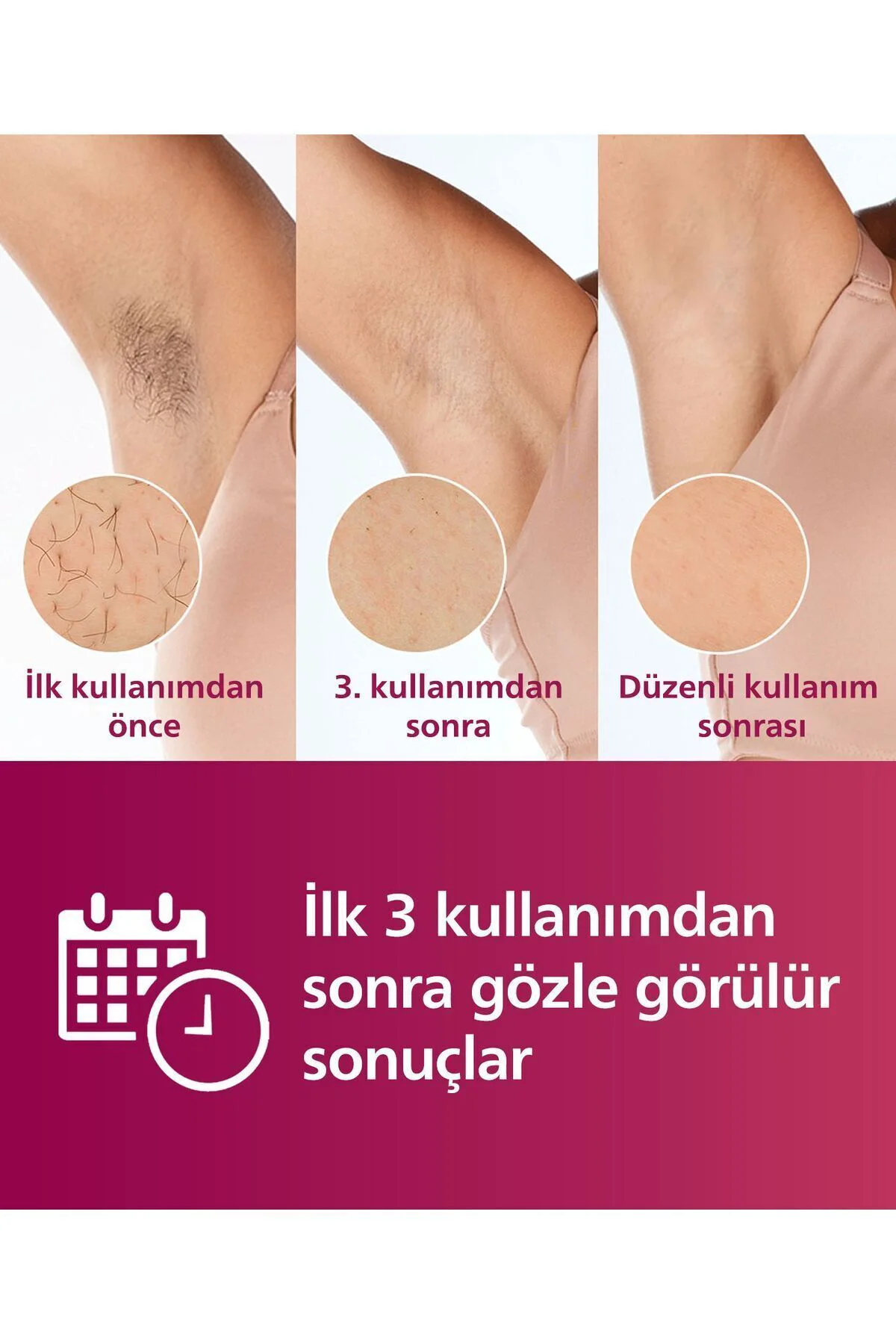 BRI950/00 Lumea Lazer Epilasyon IPL Tüy Alma Cihazı,ÇantaHEDİYELİ
