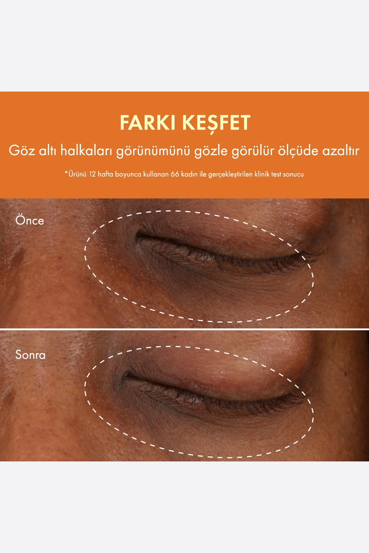 C Vitamini & Niasinamid Içeren Ginzing™ Canlandırıcı Göz Kremi 15