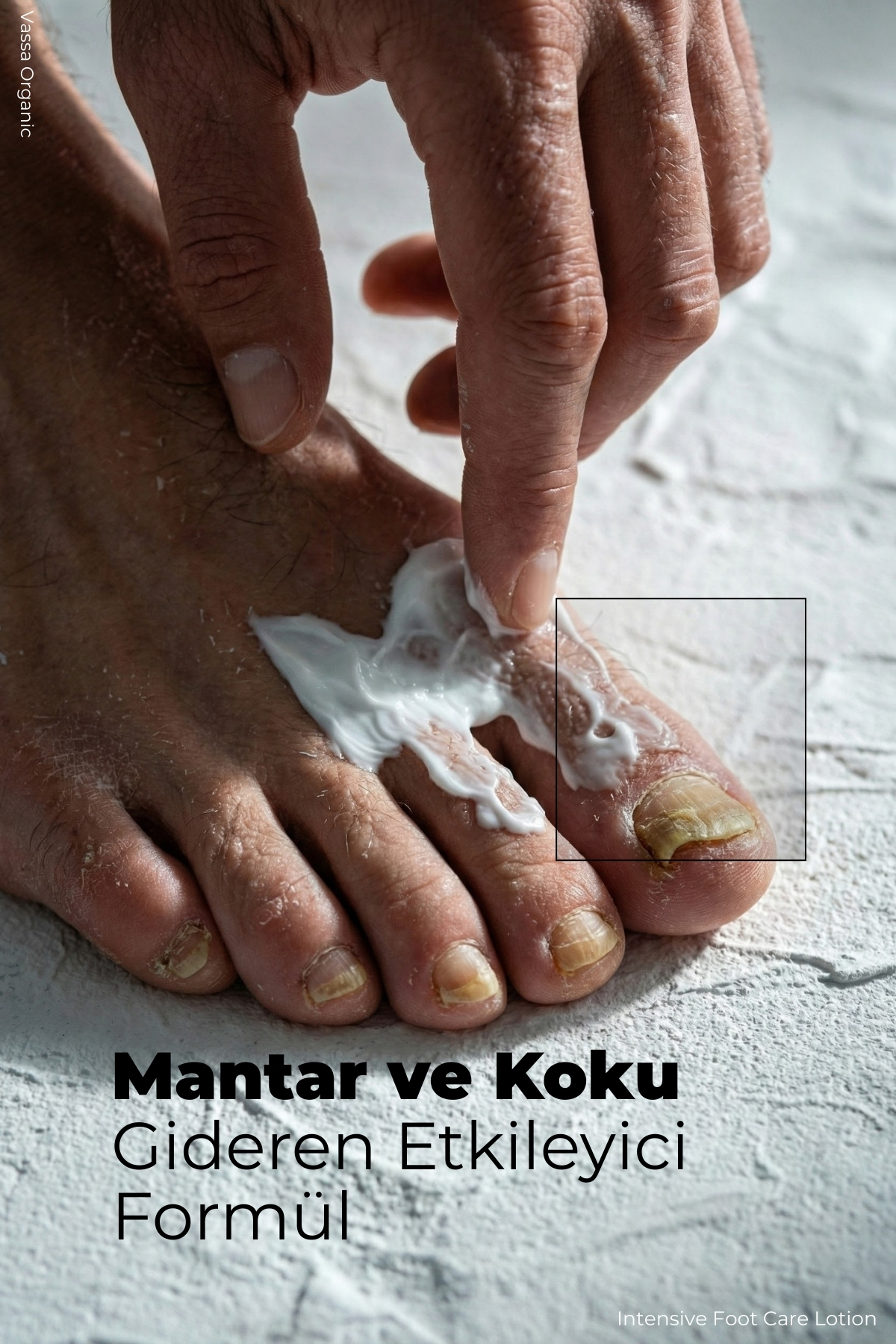 Çatlak, Mantar ve Koku Karşıtı Ayak Topuk Onarıcı Bakım Kremi – Ayak Kremi 100 ml