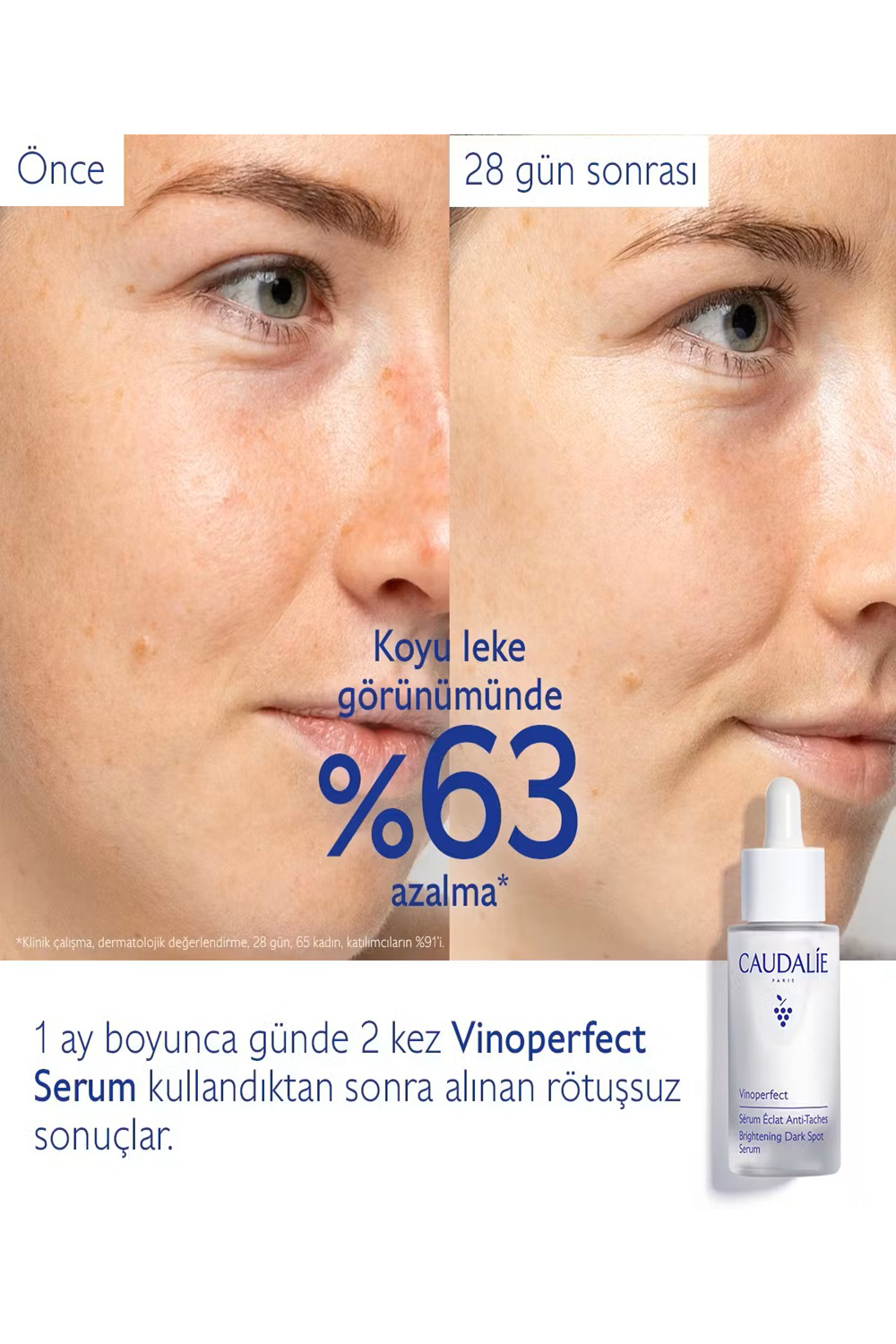 Caudalie  Vinoperfect Leke Karşıtı İşıltı Verici Serum 30 Ml