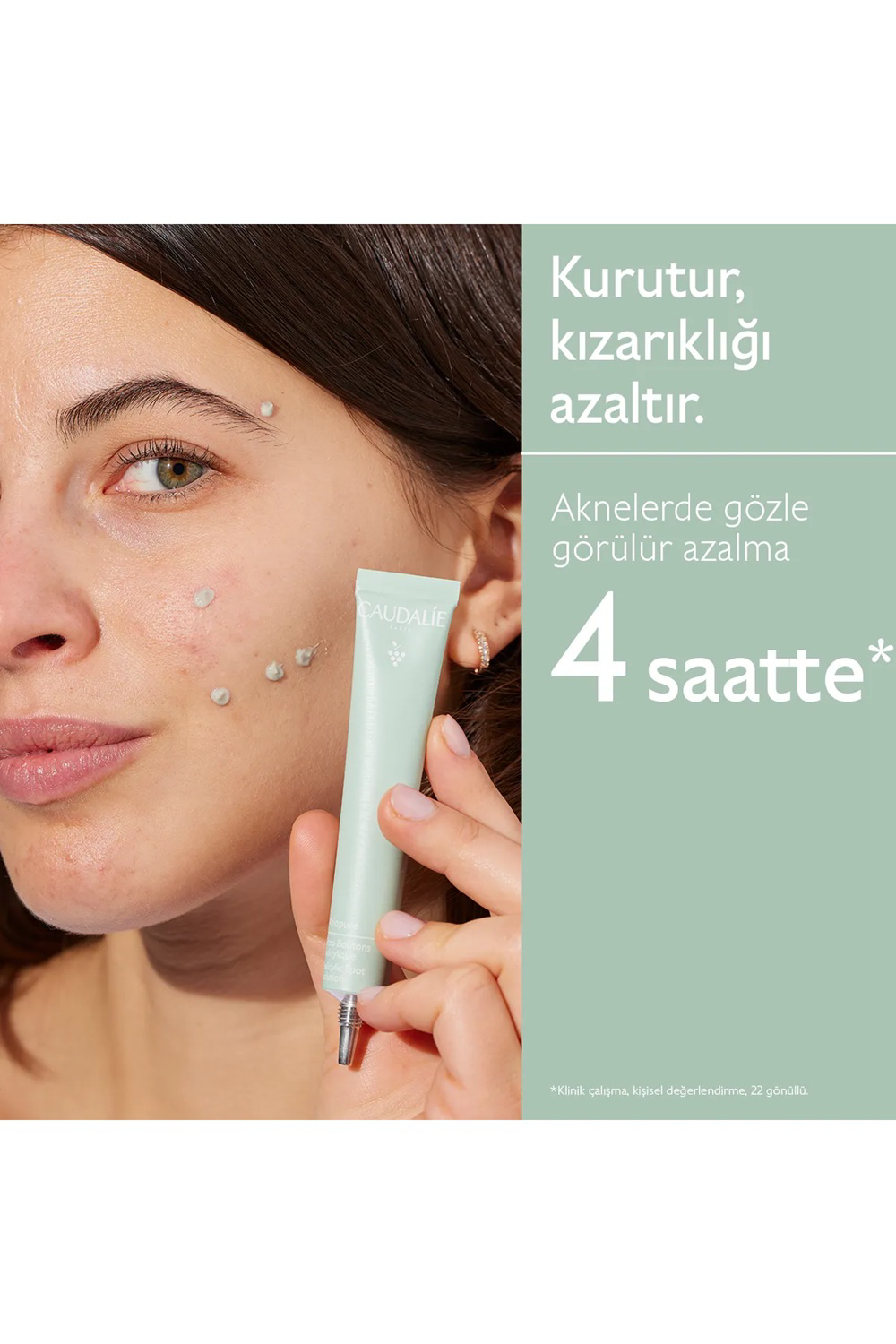 Caudalie Vinopure Akne Karşıtı Salisilik Spot Krem 15 ml Caudalie Vinopure Akne Karşıtı Salisilik Spot Krem 15 ml