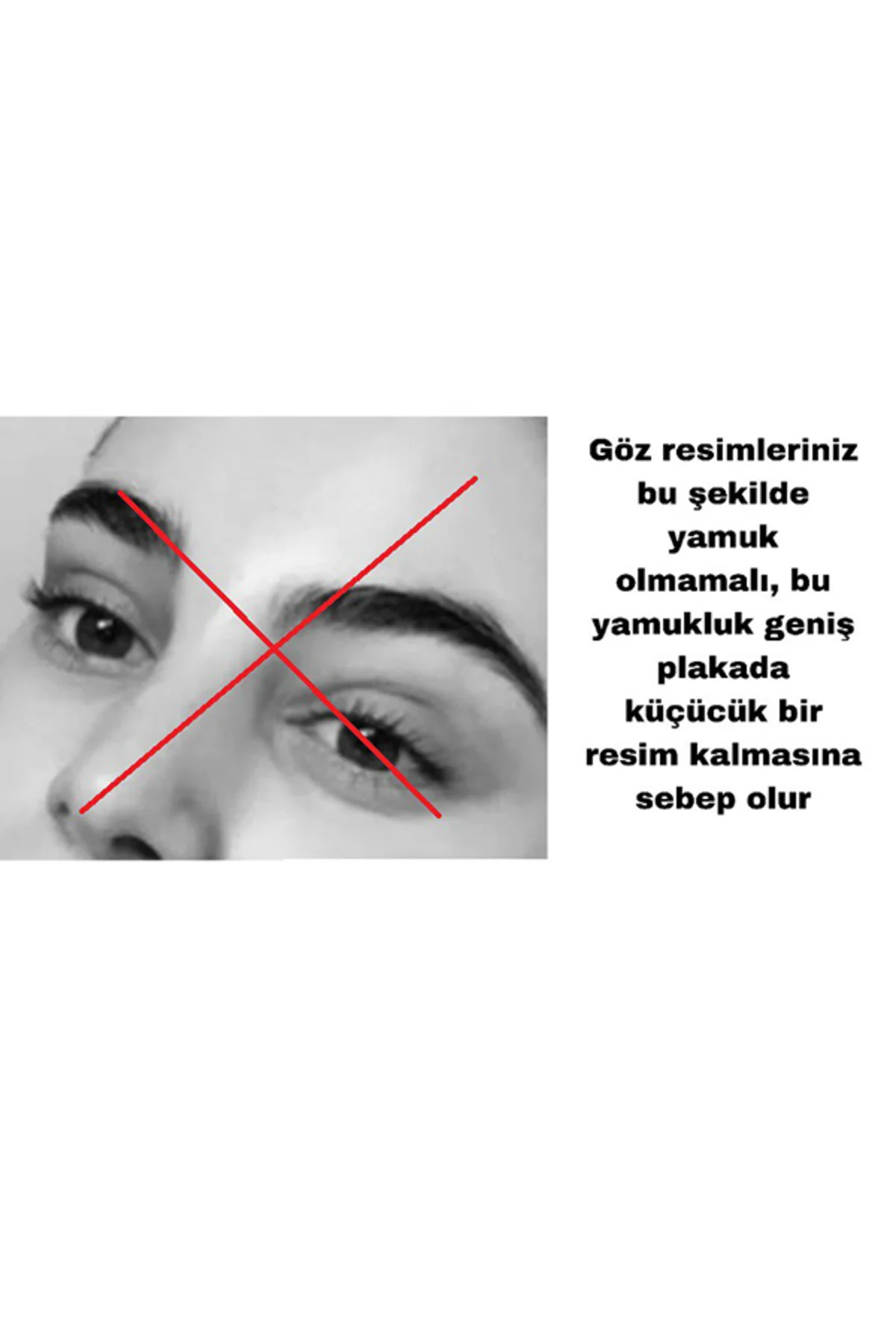 Çelik Bileklik Kişiye Özel Göz Resimli Baskılı- ASLA PASLANMAZ