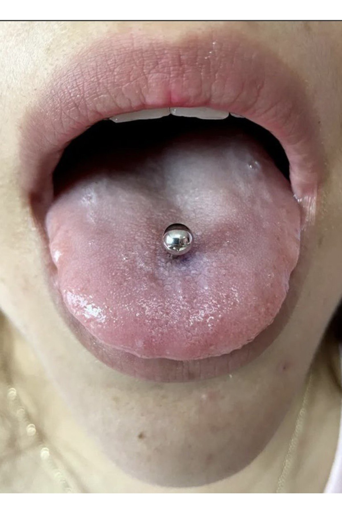 Cerrahi Çelik Gümüş Renk Dil Piercingi