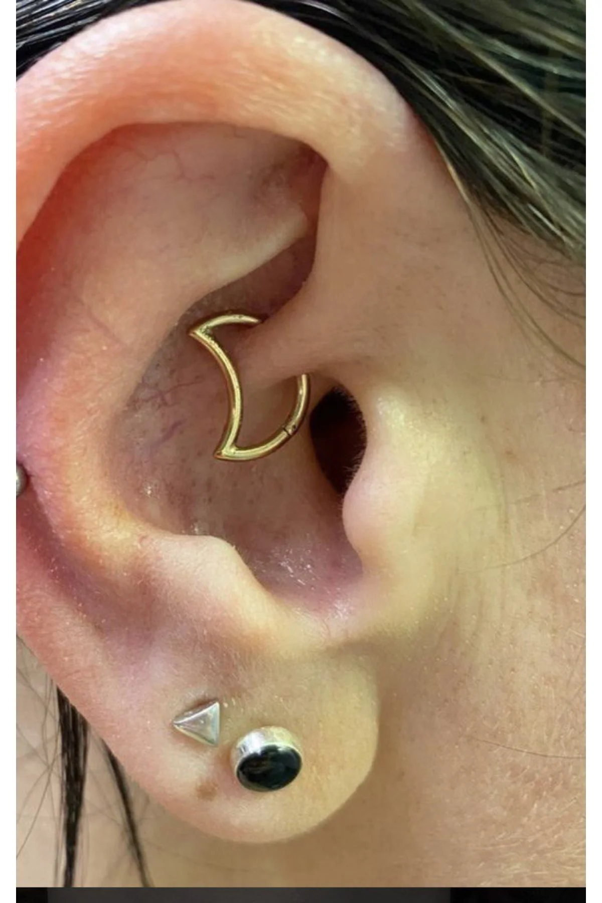 Cerrahi Çelik Rook Daith Piercing