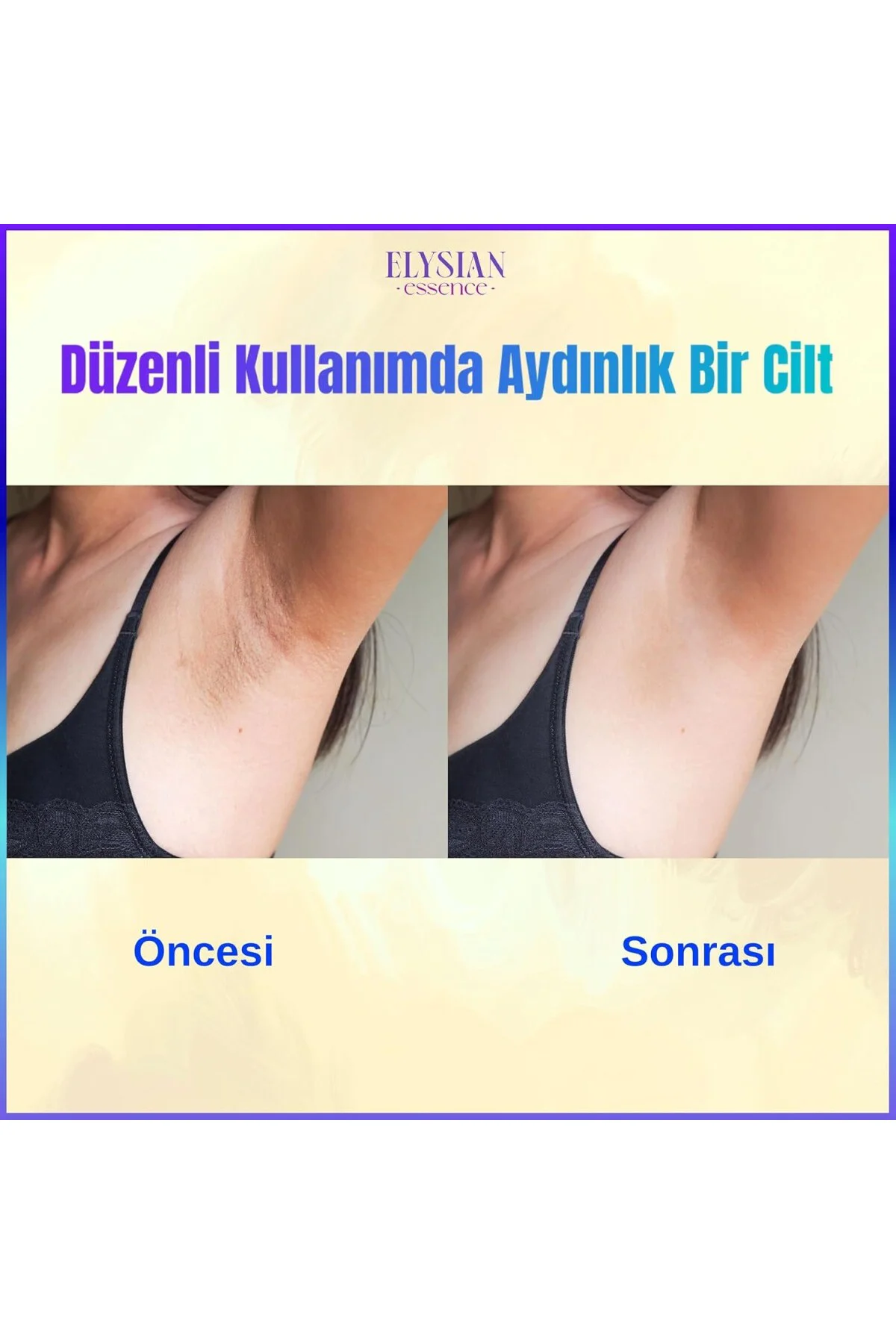 Cilt Beyazlatıcı | Kararma Giderici Krem - Genital Bölge, Koltuk 