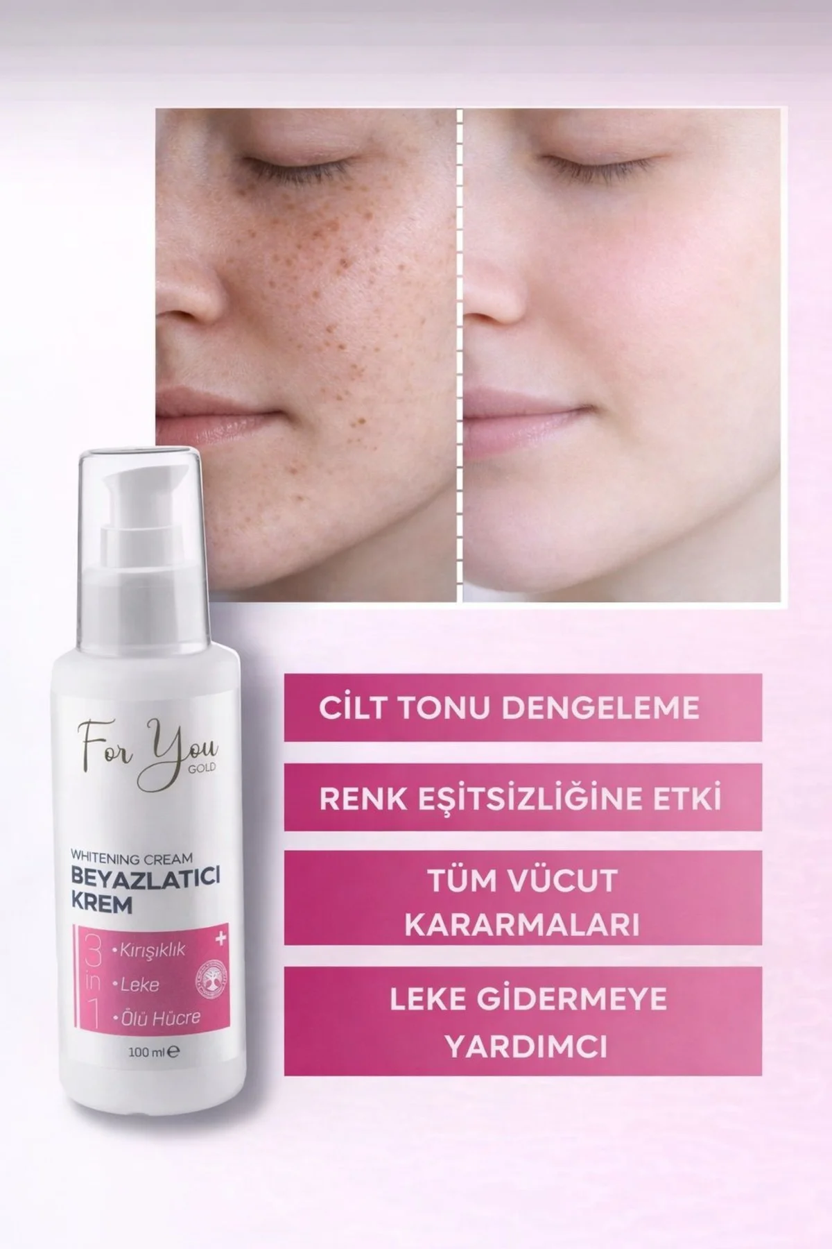 Cilt Beyazlatıcı Krem (Kararma Karşıtı - Ton Eşitleyici - Renk Aç