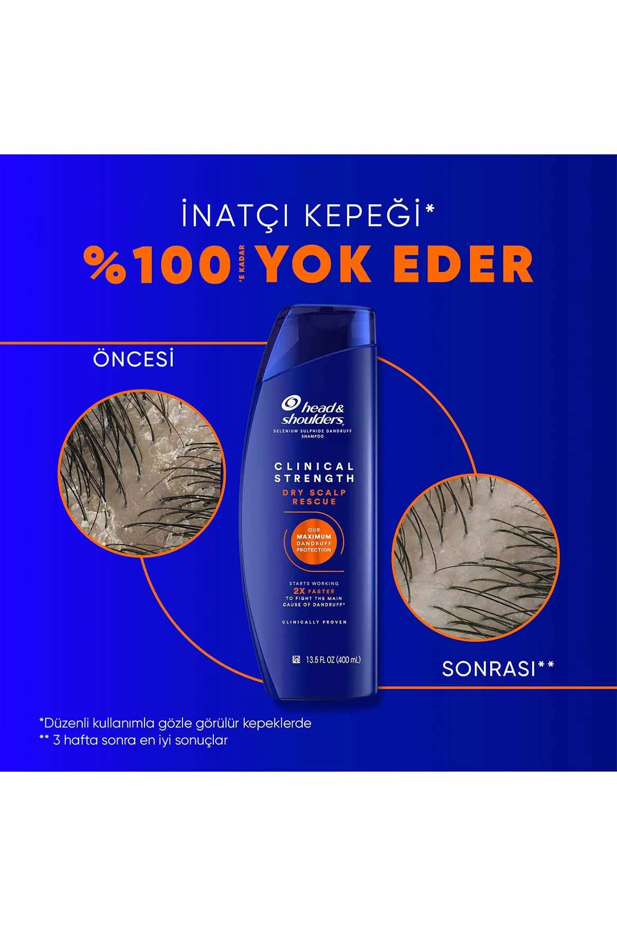 Clinical Strength Dry Scalp Rescue İnatçı Kepek Karşıtı, Kuru Saç Derisi Özel Şampuan 400 ml - Görsel 2