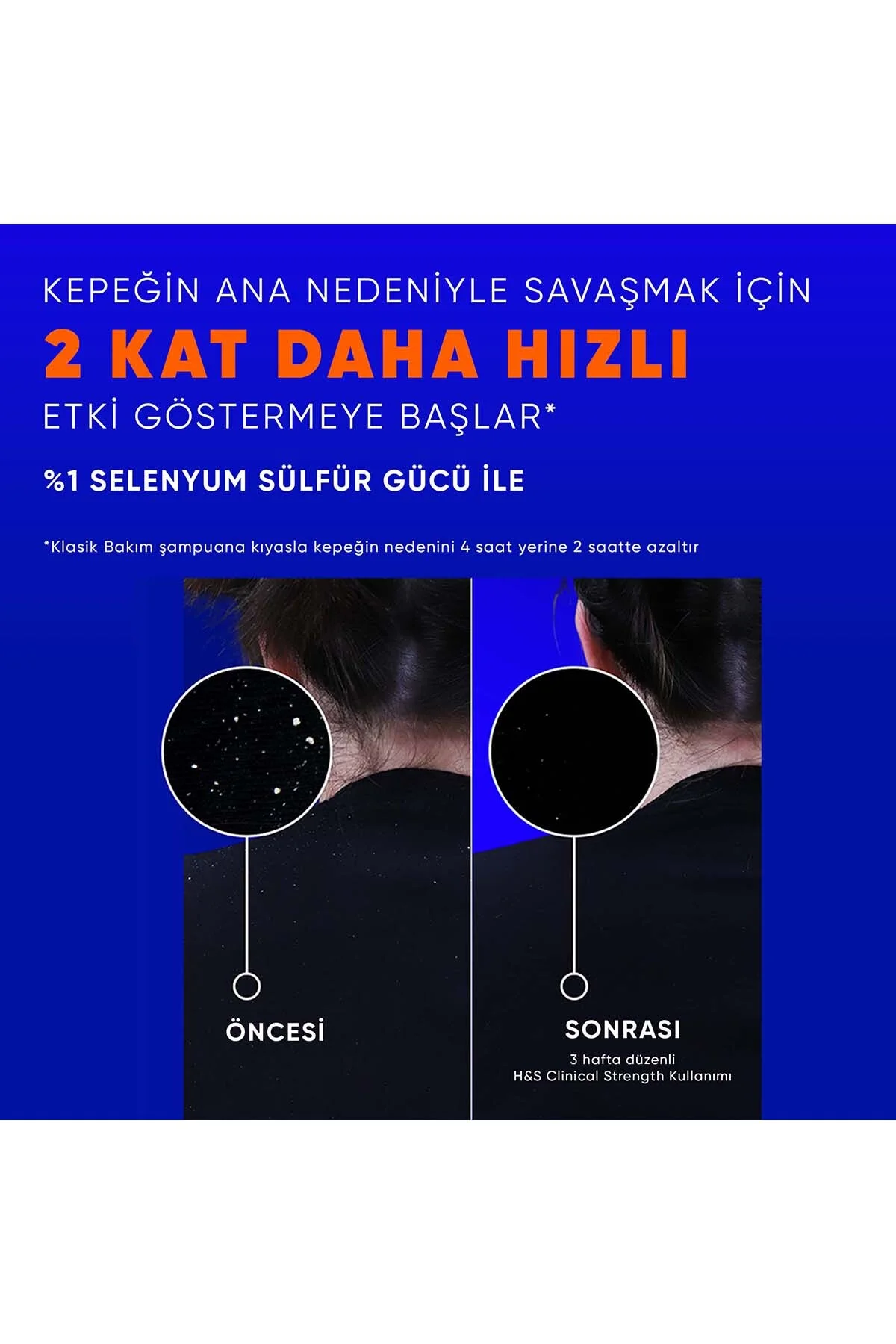 Clinical Strength Dry Scalp Rescue İnatçı Kepek Karşıtı, Kuru Saç Derisi Özel Şampuan 400 ml - Görsel 3
