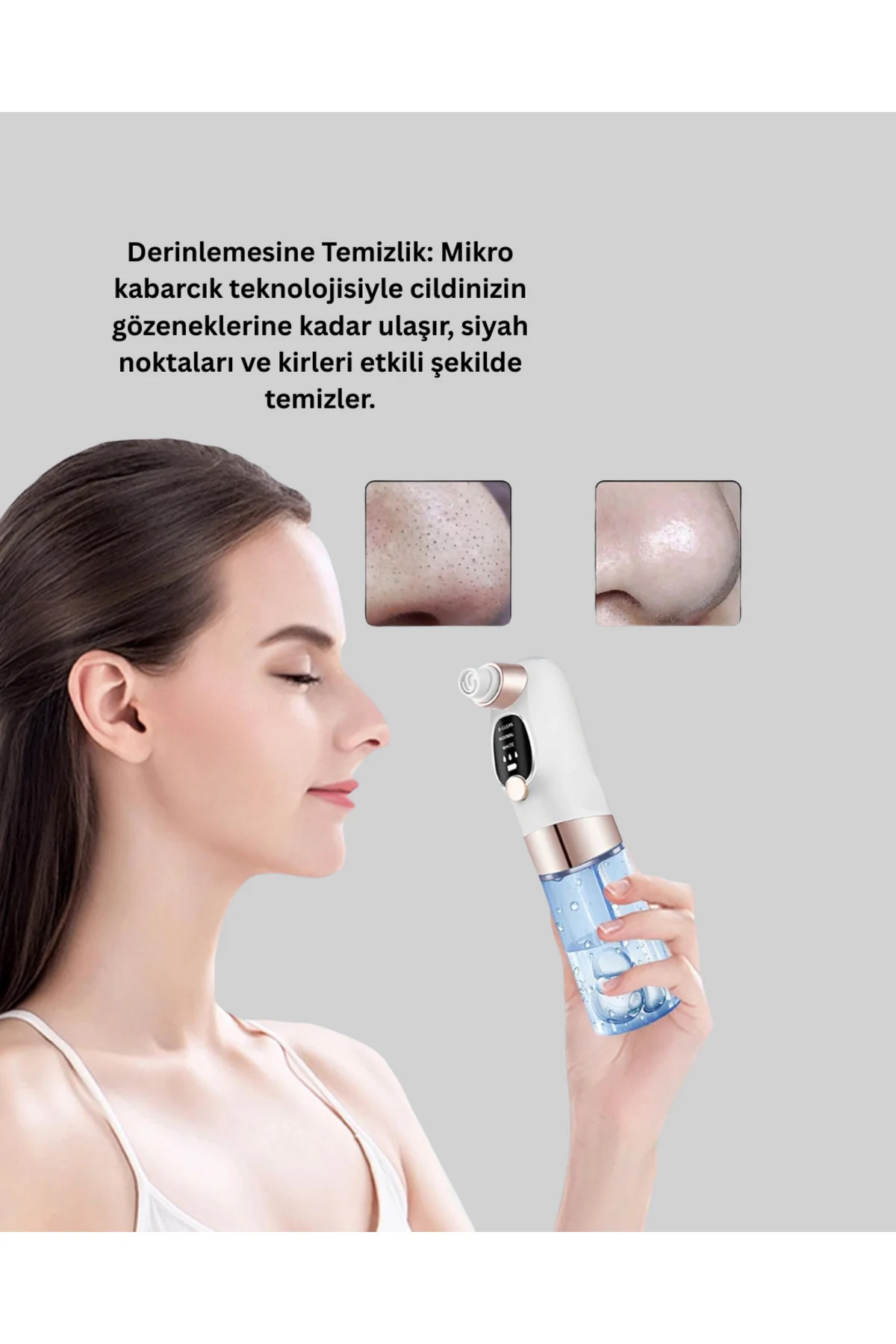 Çok Fonksiyonlu Cilt Bakım Cihazı – Siyah Nokta, Gözenek ve Akne 