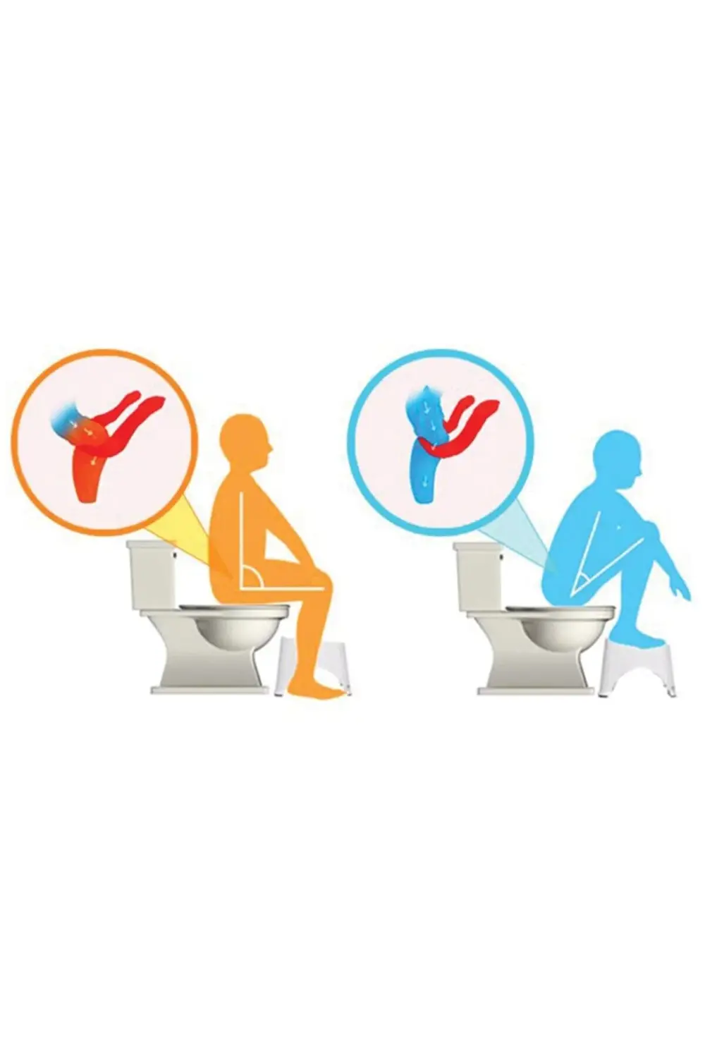 Decobella Klozet Taburesi - Wc Basamağı- Toilet Stool